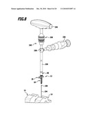 SURGICAL BONE ANCHORING DEVICE AND SPINAL COLUMN FIXATION SYSTEM diagram and image