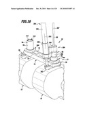 SURGICAL BONE ANCHORING DEVICE AND SPINAL COLUMN FIXATION SYSTEM diagram and image