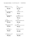 SURGICAL TOOLS FOR TREATMENT OF SPINAL STENOSIS diagram and image