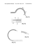 SURGICAL TOOLS FOR TREATMENT OF SPINAL STENOSIS diagram and image