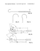 SURGICAL TOOLS FOR TREATMENT OF SPINAL STENOSIS diagram and image