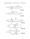 SURGICAL TOOLS FOR TREATMENT OF SPINAL STENOSIS diagram and image