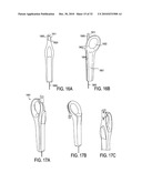 SURGICAL TOOLS FOR TREATMENT OF SPINAL STENOSIS diagram and image