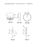 SURGICAL TOOLS FOR TREATMENT OF SPINAL STENOSIS diagram and image