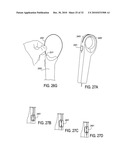 SURGICAL TOOLS FOR TREATMENT OF SPINAL STENOSIS diagram and image