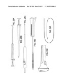 SURGICAL TOOLS FOR TREATMENT OF SPINAL STENOSIS diagram and image