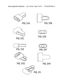 SURGICAL TOOLS FOR TREATMENT OF SPINAL STENOSIS diagram and image