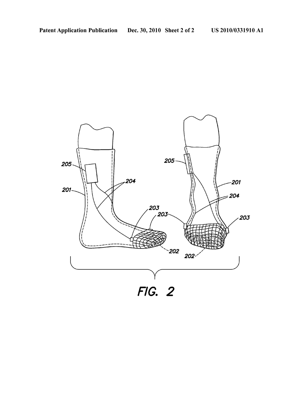 ELECTRICAL STIMULATION UNIT AND WATERBATH SYSTEM - diagram, schematic, and image 03