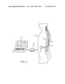 METHOD AND DEVICE FOR ACQUIRING PHYSIOLOGICAL DATA DURING TISSUE STIMULATION PROCEDURE diagram and image