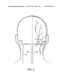 SYSTEM AND METHOD FOR COMPENSATING FOR SHIFTING OF NEUROSTIMULATION LEADS IN A PATIENT diagram and image