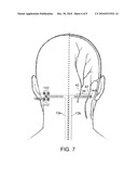 SYSTEM AND METHOD FOR COMPENSATING FOR SHIFTING OF NEUROSTIMULATION LEADS IN A PATIENT diagram and image