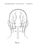 SYSTEM AND METHOD FOR COMPENSATING FOR SHIFTING OF NEUROSTIMULATION LEADS IN A PATIENT diagram and image