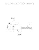 IMPLANTABLE MEDICAL DEVICE LEAD diagram and image