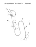 IMPLANTABLE MEDICAL LEAD CONFIGURED FOR IMPROVED MRI SAFETY AND HEATING REDUCTION PERFORMANCE diagram and image