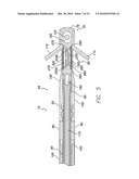 IMPLANTABLE MEDICAL LEAD CONFIGURED FOR IMPROVED MRI SAFETY AND HEATING REDUCTION PERFORMANCE diagram and image