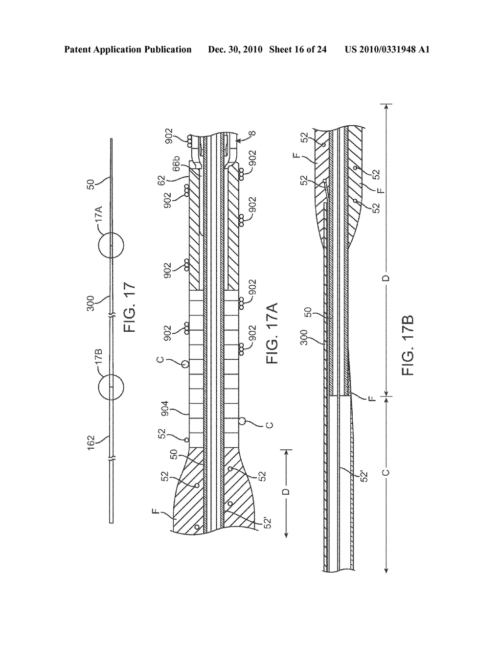 IMPLANT DELIVERY APPARATUS AND METHODS WITH ELECTROLYTIC RELEASE - diagram, schematic, and image 17