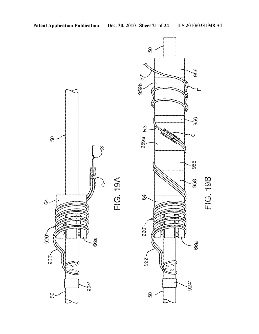 IMPLANT DELIVERY APPARATUS AND METHODS WITH ELECTROLYTIC RELEASE - diagram, schematic, and image 22