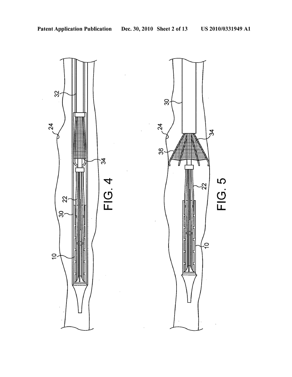 STENTS, DEVICES FOR USE WITH STENTS AND METHODS RELATING THERETO - diagram, schematic, and image 03