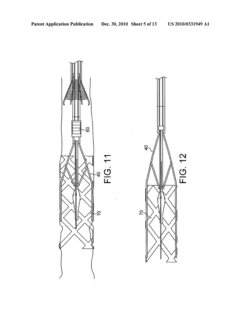 STENTS, DEVICES FOR USE WITH STENTS AND METHODS RELATING THERETO - diagram, schematic, and image 06