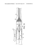 STENTS, DEVICES FOR USE WITH STENTS AND METHODS RELATING THERETO diagram and image