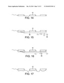 STENTS, DEVICES FOR USE WITH STENTS AND METHODS RELATING THERETO diagram and image