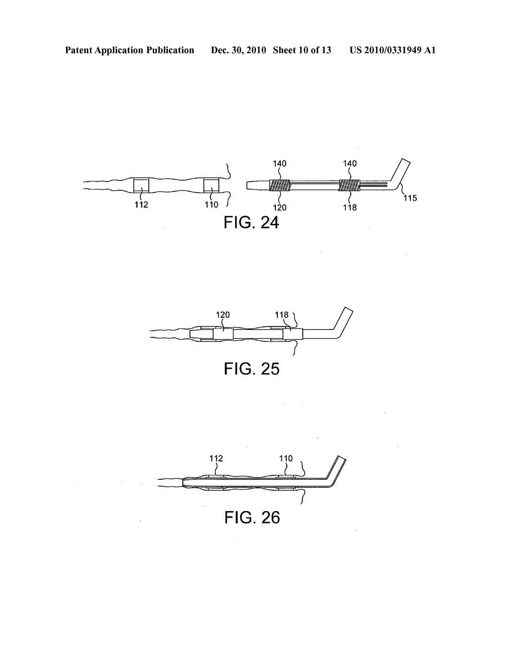 STENTS, DEVICES FOR USE WITH STENTS AND METHODS RELATING THERETO - diagram, schematic, and image 11