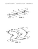 STENTS, DEVICES FOR USE WITH STENTS AND METHODS RELATING THERETO diagram and image