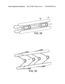 STENTS, DEVICES FOR USE WITH STENTS AND METHODS RELATING THERETO diagram and image