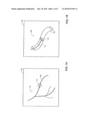 SYSTEM AND METHOD FOR DELIVERING A STENT TO A SELECTED POSITION WITHIN A LUMEN diagram and image