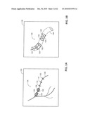 SYSTEM AND METHOD FOR DELIVERING A STENT TO A SELECTED POSITION WITHIN A LUMEN diagram and image