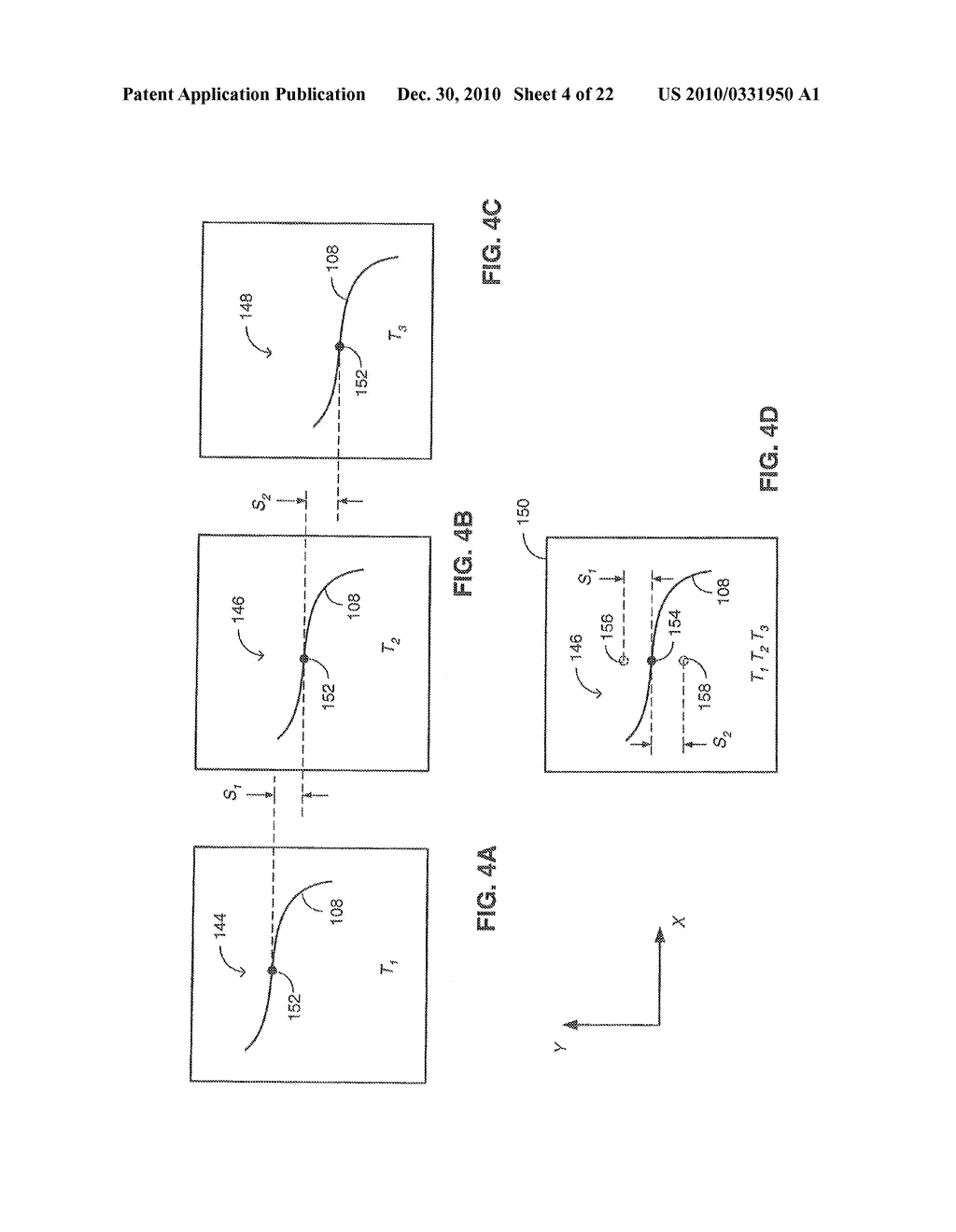 SYSTEM AND METHOD FOR DELIVERING A STENT TO A SELECTED POSITION WITHIN A LUMEN - diagram, schematic, and image 05