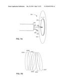 SYSTEM AND METHOD FOR DELIVERING A STENT TO A SELECTED POSITION WITHIN A LUMEN diagram and image