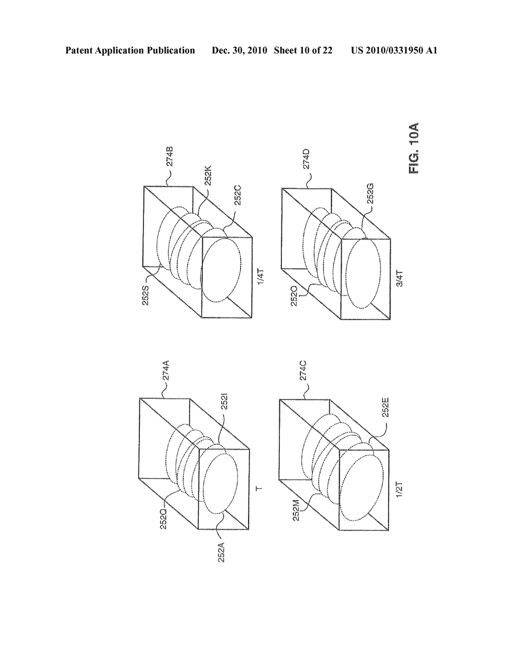 SYSTEM AND METHOD FOR DELIVERING A STENT TO A SELECTED POSITION WITHIN A LUMEN - diagram, schematic, and image 11