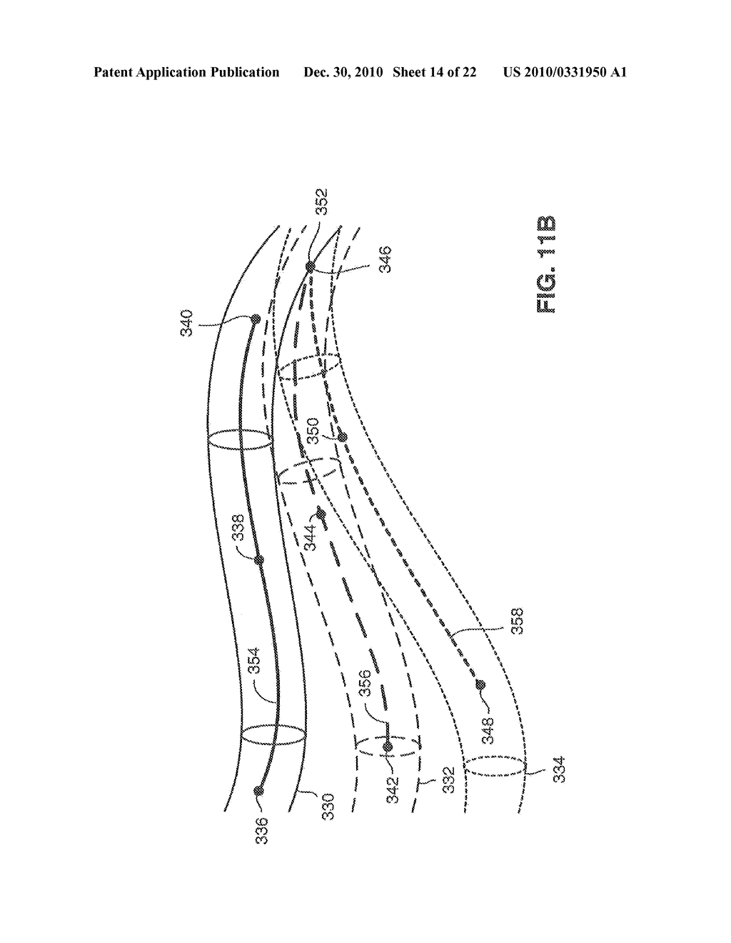 SYSTEM AND METHOD FOR DELIVERING A STENT TO A SELECTED POSITION WITHIN A LUMEN - diagram, schematic, and image 15