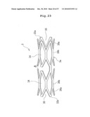 STENT DELIVERY DEVICE diagram and image