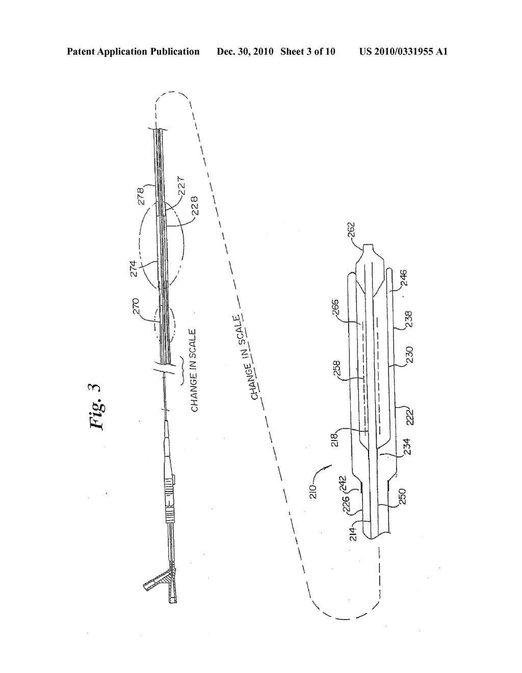 ROLLING MEMBRANE STENT DELIVERY SYSTEM - diagram, schematic, and image 04