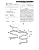 STENT WITH IMPROVED STENT DESIGN diagram and image