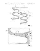 STENT WITH IMPROVED STENT DESIGN diagram and image