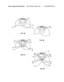 FIBER MATRIX FOR MAINTAINING SPACE IN SOFT TISSUES diagram and image