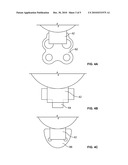 FIBER MATRIX FOR MAINTAINING SPACE IN SOFT TISSUES diagram and image