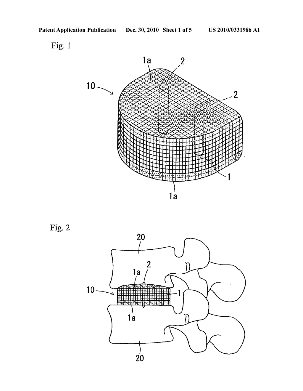 BIOMATERIAL FOR ARTIFICIAL CARTILAGE - diagram, schematic, and image 02