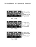 Cottonwood Growth eIF-5A diagram and image