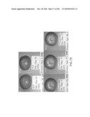 Cottonwood Growth eIF-5A diagram and image