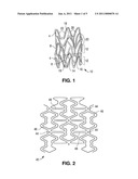 Method And Apparatus For Attaching Radiopaque Markers To A Stent diagram and image