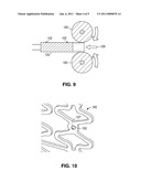 Method And Apparatus For Attaching Radiopaque Markers To A Stent diagram and image