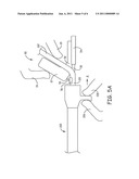 SLITTING TOOL diagram and image