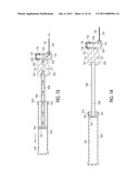 Pump with Pivoting Needle diagram and image