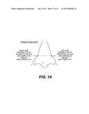 EXTERNAL NASAL DILATOR diagram and image