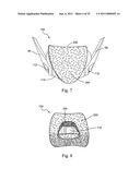 FOAM RESPIRATORY MASK diagram and image