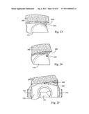 FOAM RESPIRATORY MASK diagram and image